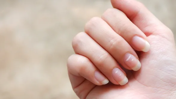 What Do The Little White Spots On Nails Mean