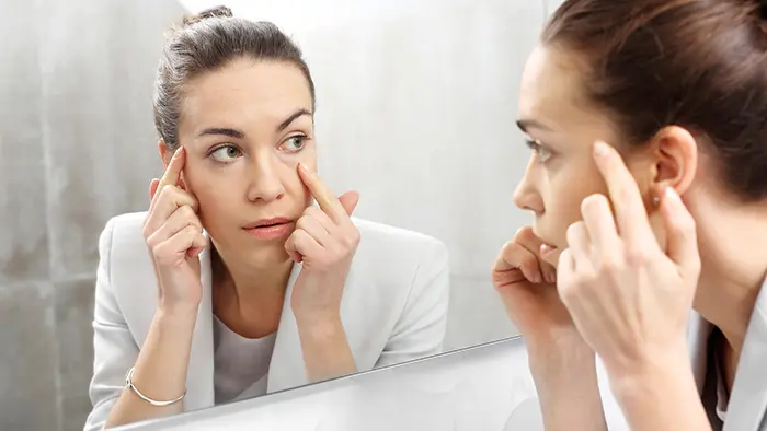 How to Get Rid of Dark Circles Naturally