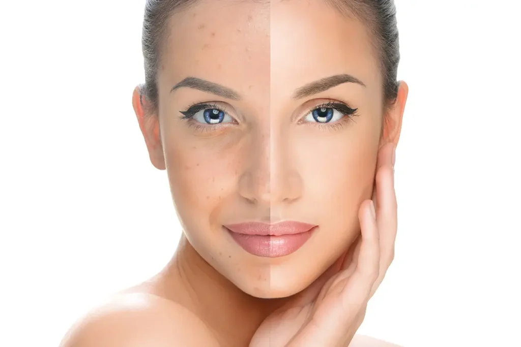 Slugging: Overnight Relief for Thirsty, Damaged Skin
